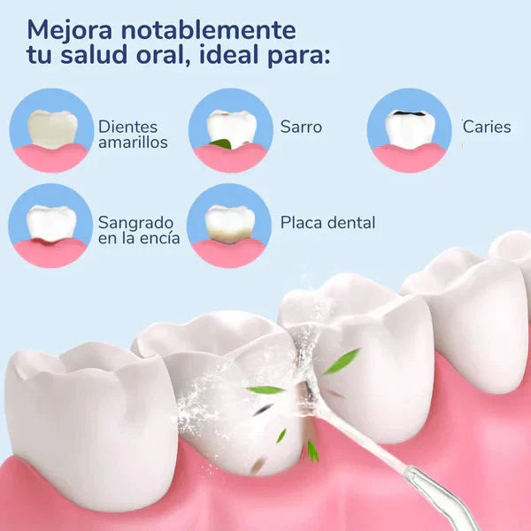 IRRIGADOR DENTAL LIMPIADOR ORAL - LA SOLUCIÓN PARA UNA HIGIENE BUCAL COMPLETA (ENVÍO GRATIS)