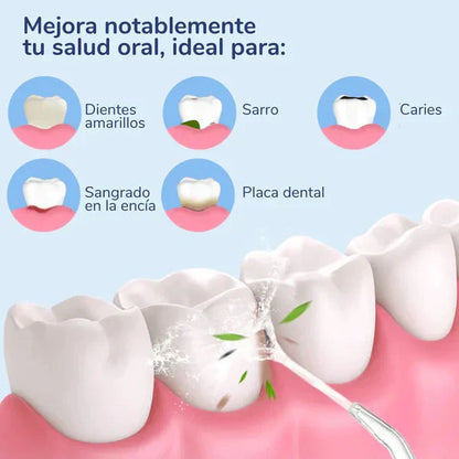 IRRIGADOR DENTAL LIMPIADOR ORAL - LA SOLUCIÓN PARA UNA HIGIENE BUCAL COMPLETA (ENVÍO GRATIS)