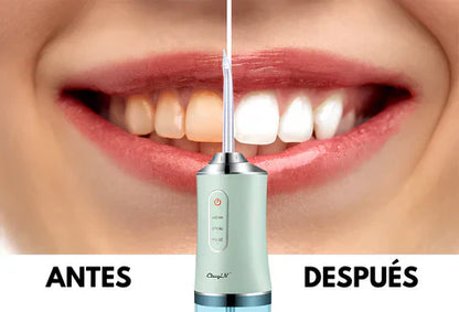 IRRIGADOR DENTAL LIMPIADOR ORAL - LA SOLUCIÓN PARA UNA HIGIENE BUCAL COMPLETA (ENVÍO GRATIS)
